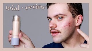fenty skin watch ya tone niacinamide dark spot serum | trial + review