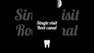 Single visit Root canal #dentist #hyderabad #saddar #qasimabad #rootcanalspecialist #rootcanals