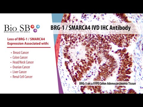 Bio SB - 2021 New BRG-1 / SMARCA4 Antibody for IHC
