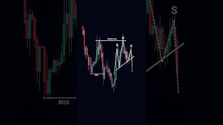 Head and Shoulders Pattern Trading | Smart Trend Continuation Setup