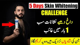Best Skin Whitening Cream in Pakistan | Fastest Skin Whitening Cream | Skin Whitening