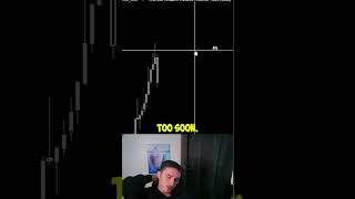 Identifying Day Trading Problems is Easy Fixing Is Hard #daytrading #howtodaytrade #shorts #viral