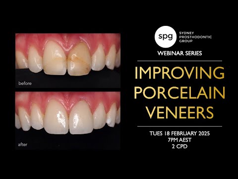 SPG Webinar: Improving Porcelain Veneers