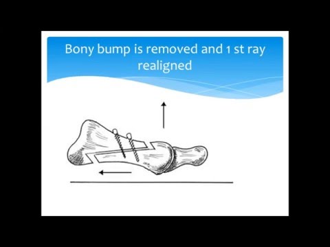 Best diabetic foot surgeon in Hyderabad-9246118509