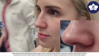 5  Naczynka i rumień 2