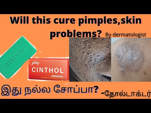 original/old cinthol soap review by dermatologist,will it cure pimples/ skin problems?