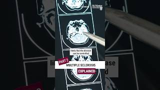 PT2: Multiple Sclerosis Explained: Here’s what you need to know about MS #multiplesclerosis #shorts