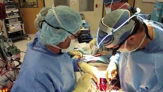 Life in the OR: Open heart surgery