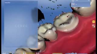 4  DIGITAL IMPRESSION