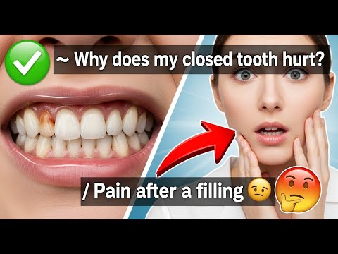 ✅ Why does my closed tooth hurt? / Pain after a filling 👈😳