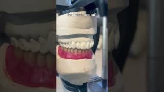 Ivo base denture. 🦷 #dentalstudent #dentalwork #dental #dentaltips #shorts #dentist