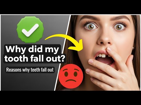 ✅ Why did my tooth fall out? / Reasons why teeth fall out 👈😳