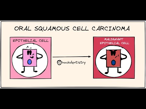 Oral squamous cell carcinoma - Etiology and Pathogenesis