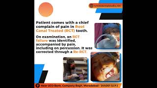 🦷 𝐒𝐮𝐜𝐜𝐞𝐬𝐬𝐟𝐮𝐥 𝐑𝐞𝐬𝐨𝐥𝐮𝐭𝐢𝐨𝐧 𝐨𝐟 𝐑𝐂𝐓 𝐅𝐚𝐢𝐥𝐮𝐫𝐞 𝐰𝐢𝐭𝐡 𝐑𝐞-𝐑𝐨𝐨𝐭 𝐂𝐚𝐧𝐚𝐥 𝐓𝐫𝐞𝐚𝐭𝐦𝐞𝐧𝐭! ✨