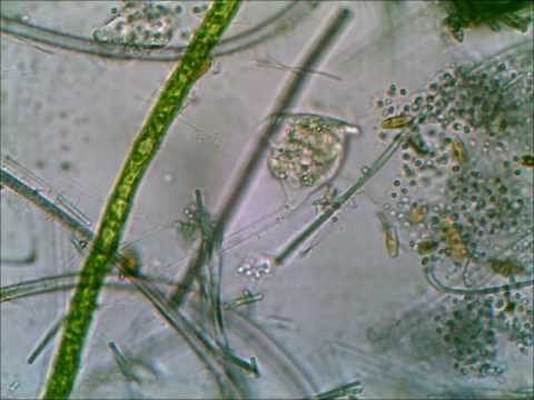Vorticella at 400X Taken with Tucsen Microscope Camera Using TSView with Xvid Compression