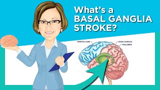 Basal Ganglia Stroke
