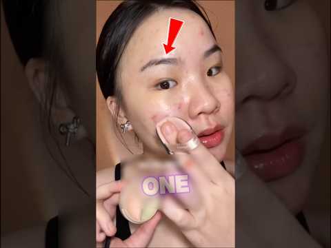 Skin breakout ....how??