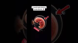 #babyusg #ultrasound #babyultrasound #pregnancyscan #pregnant #babyscan