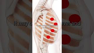 The Intercostal Muscle Trigger Points