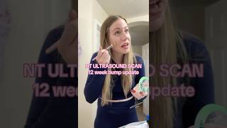 NT ultrasound for baby#pregnant #ntscan #12weekspregnant #ultrasound #2ndtrimester #secondtrimester