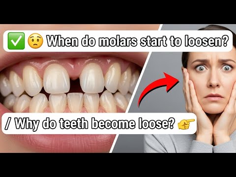 ✅ When do molars start to loosen? / Why do teeth become loose? 👈😳