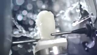 CEREC Restoration ( Crowns, Veneer and Fillings)
