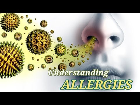 What is ALLERGIES?