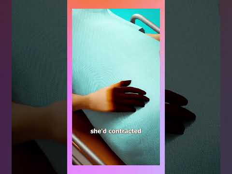 Eating This Fish Caused Amputations   #shortclip #shortvideos