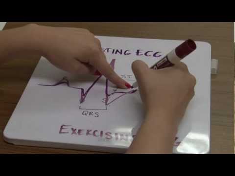 Electrocardiography 2012