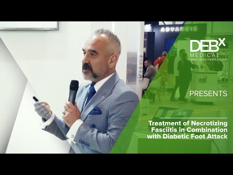 Treatment of Necrotizing Fasciitis in Combination with Diabetic Foot Attack