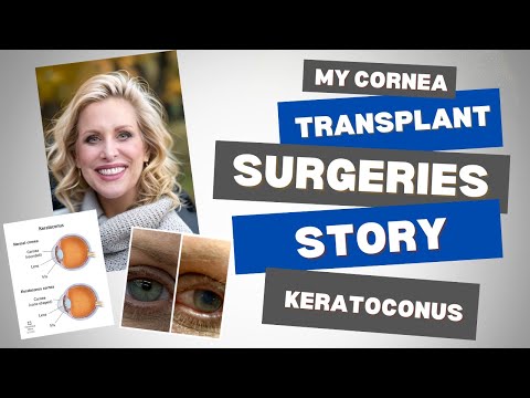 Are You Facing Major Eye Surgery? | I've Had 5 Cornea Transplants - Feel Prepared and At Ease