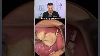 This Is The Most SATISFYING Dental Procedure! 😂🦷