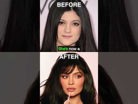 Kylie Jenner: Before & After Transformation! ✨😱