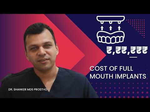 What is the Cost of Full Mouth Implants? | Dental Tips by Doctor Shanker #fullmouthrehabilitation