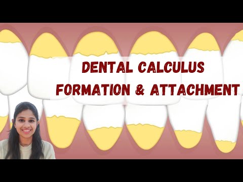 DENTAL CALCULUS (Part II) ‖ Theories of Calculus Formation ‖ Dental Calculus Made Easy ‖ Perio Hub