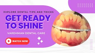 Sparkling Teeth In Minutes: Effortless Dental Cleaning