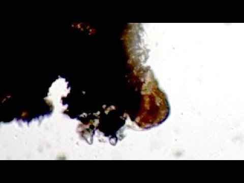 Found a Tardigrade but don't know how to use a Microscope